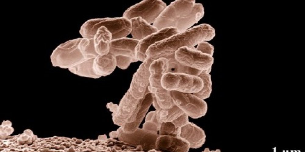 Antimicrobico-resistenza, Antibiotico-resistenza e l&#8217;Era Post-Antibiotica